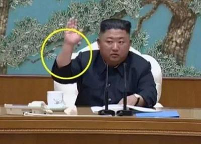 راز جای سوزن روی دست رهبر کره شمالی چیست؟، عکس