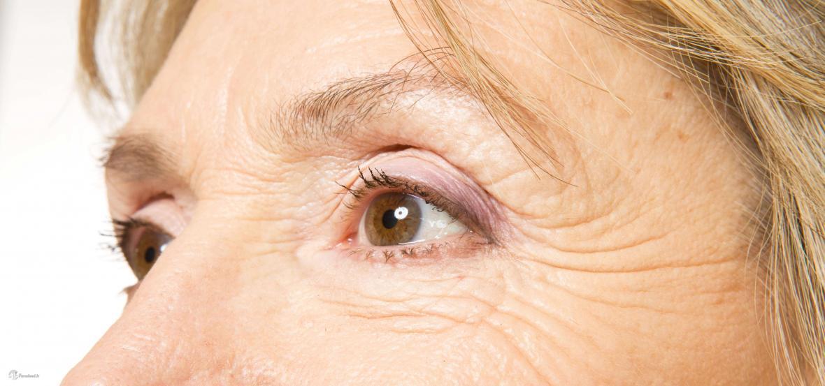درمان چروک دور چشم با ترکیب ساده یک میوه و دارویی دَم دستی